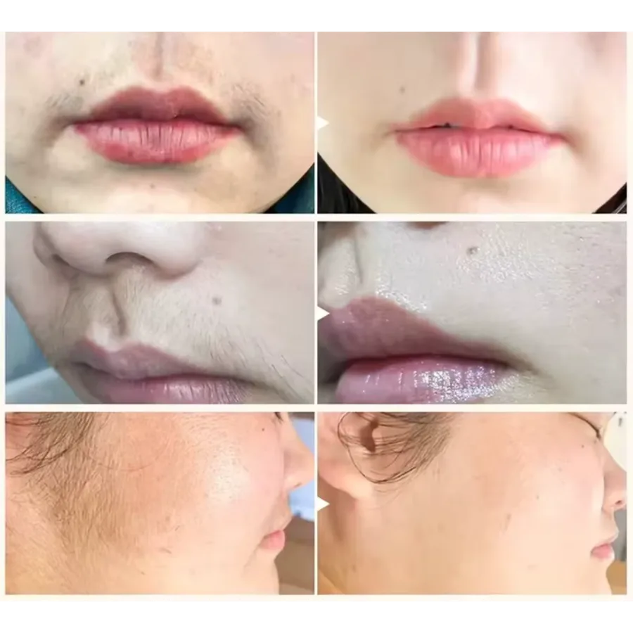 Rostro antes y después